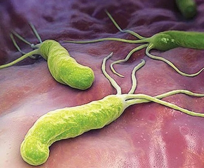 Vi khuẩn Helicobacter pylori (H. pylori) và viêm dạ dày